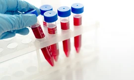 Nghi phạm dùng vật nhọn khiến 10 người phơi nhiễm HIV khai gì?