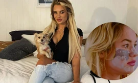 Ngôi sao truyền hình Úc biến dạng mặt vì 'đu trend' TikTok