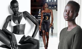 Mẫu nữ từng là trẻ tị nạn gây sốt vì tỷ lệ cơ thể như búp bê