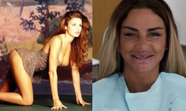 'Thảm họa dao kéo' nước Anh thừa nhận tu sửa vòng một tới 12 lần