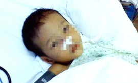 Bé trai 3 tuổi bị bạn gái của bố đánh nhập viện