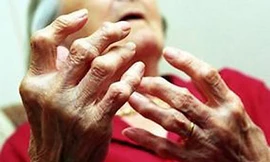 Những bệnh khớp người cao tuổi thường mắc