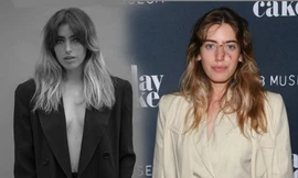 Diễn viên Hollywood gây hoang mang vì mang gương mặt vừa bị chó cắn chảy máu lên thảm đỏ