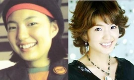 Sao Hàn ‘lột xác’ nhờ dao kéo