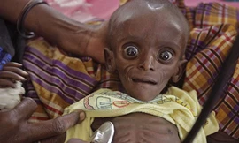 Nạn đói hoành hành ở Somalia