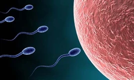 Vì sao bị thiểu năng tinh trùng?