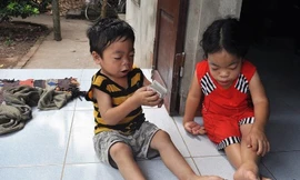 Thiếu nữ 18 tuổi trông như trẻ lên 5