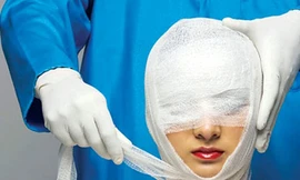 Mặt trái của phẫu thuật thẩm mỹ