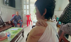 Vụ thai phụ bị chồng bạo hành dã man: Hội LHPN Kiên Giang, Hải Dương vào cuộc