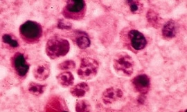 Ký sinh trùng ăn não người