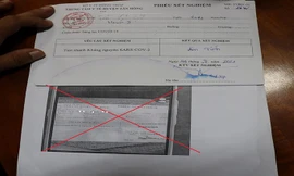 Thanh niên sửa kết quả xét nghiệm COVID-19 từ âm thành dương tính rồi đăng Facebook