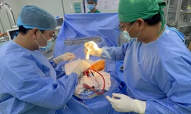 Em trai cầm kéo đuổi mèo hoang không may đâm xuyên đầu chị