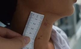 Vụ cha dượng hành hạ con riêng của vợ: Vùng kín 'bị tổn thương nghiêm trọng'