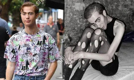 Sao truyền hình Anh gây sốc với thân hình ‘bộ xương di động’