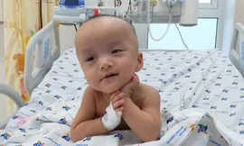 Trúc Nhi, Diệu Nhi sau một tháng mổ tách