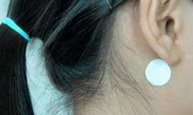 Ai không nên dùng cao dán chống nôn?