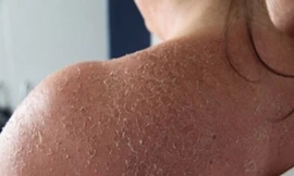 'Cuồng' trắng da, hết hồn vì gặp 'phù thủy sắc đẹp'