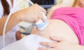 Về tác dụng của dung dịch này, PGS. TS. Vũ Bá Quyết - Giám đốc BV Phụ sản Trung ương cho biết: Ngành sản khoa Việt Nam chưa bao giờ tư vấn cũng như sử dụng bất cứ một phương pháp nào để lựa chọn giới tính thai nhi cho các sản phụ.