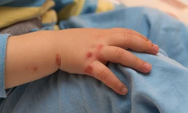 Ảnh minh hoạ: Internet