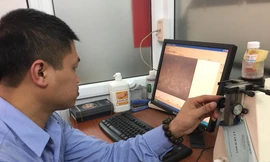 Ông Nguyễn Hữu Hoàng - GĐ Ngân hàng Mắt TƯ và chiếc lọ đựng giác mạc bé Hải An hiến tặng. Ảnh: Đức Long