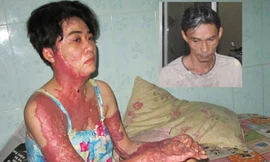 Chồng tạt xăng thiêu sống vợ