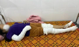 Dựng cây nêu Tết vướng đường điện cao thế, 3 người bị điện giật bỏng nặng