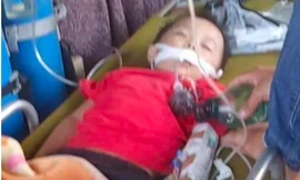 Ngủ dưới nền nhà, bé 3 tuổi bị rắn cực độc cắn nguy kịch