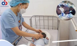 Nghệ An: Cứu sống hai trẻ sơ sinh nguy kịch do bị thủy đậu 