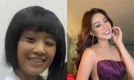 Từ Ngọc Hân đến Khánh Vân, những nàng hậu "lột xác" nhờ phép màu mang tên niềng răng