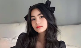 Chỉ vì "dậy thì quá thành công" mà em gái Lọ Lem bị nghi ngờ "đụng dao kéo"