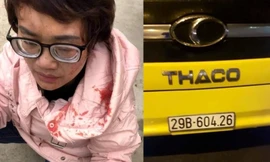 Chị Hằng sau khi bị hành hung và biển số xe khách được nhân chứng chụp lại