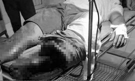 Một thanh niên bị chém đứt rời chân khi tham gia hỗn chiến