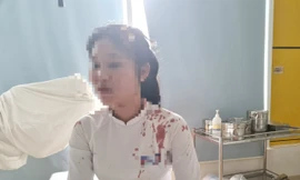 Nguyên nhân ban đầu vụ nữ sinh dùng guốc đánh bạn cùng lớp chảy máu đầu