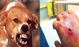 Chủ nhà tử vong sau 3 tháng bị chó cắn vào cổ tay