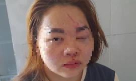 Tin mới vụ thầy giáo ở Đắk Lắk đánh vợ nhập viện cấp cứu