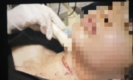 Xử phạt cô gái hoang báo bị cứa cổ cướp của