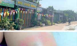 Bé gái 4 tuổi nghi bị cô giáo đánh bầm tím vì đi vệ sinh trong quần