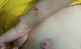 Thai phụ bị đánh hội đồng phải nhập viện cấp cứu