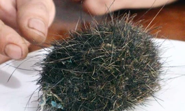 Phát hiện vật thể lạ nghi 'trứng vàng' quý hiếm trong dạ dày lợn ở Bình Phước