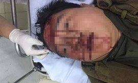 Anh Thế bị các đối tượng hành hung phải nhập viện.