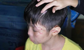 Tin nóng 24H: Cuộc sống đọa đầy của bé trai nghi bị bố bạo hành