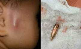 Bản tin 8H: Đạn lạc găm trúng nhiều người ở Vĩnh Phúc