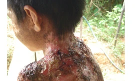 Cuộc sống cơ cực của những người bị 'quỷ ám'