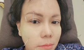 Việt Hương bị méo mặt