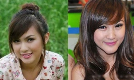 Những ca mổ kinh hoàng của Hot girl suýt mất... cằm vì làm đẹp