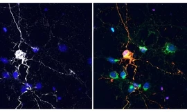 Mỹ: Nghiên cứu thuốc trị ung thư đạt được điều bất ngờ
