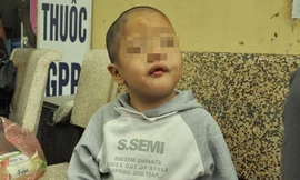 Bé 6 tuổi vá 'đời con gái'