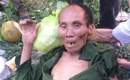 Cứu cụ ông ngất xỉu bên đường vì đói