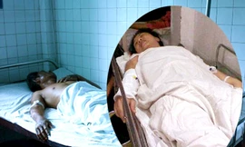 Nạn nhân vụ tạt a xít hỏi thăm... hung thủ