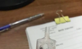 Kinh hoàng vắt sống cả tháng trong mũi của bé 8 tuổi